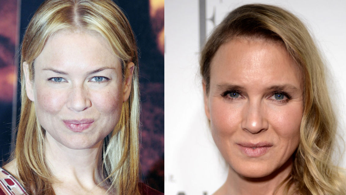Renee Zellweger Looks Unrecognizable at ELLE's Women in Hollywood