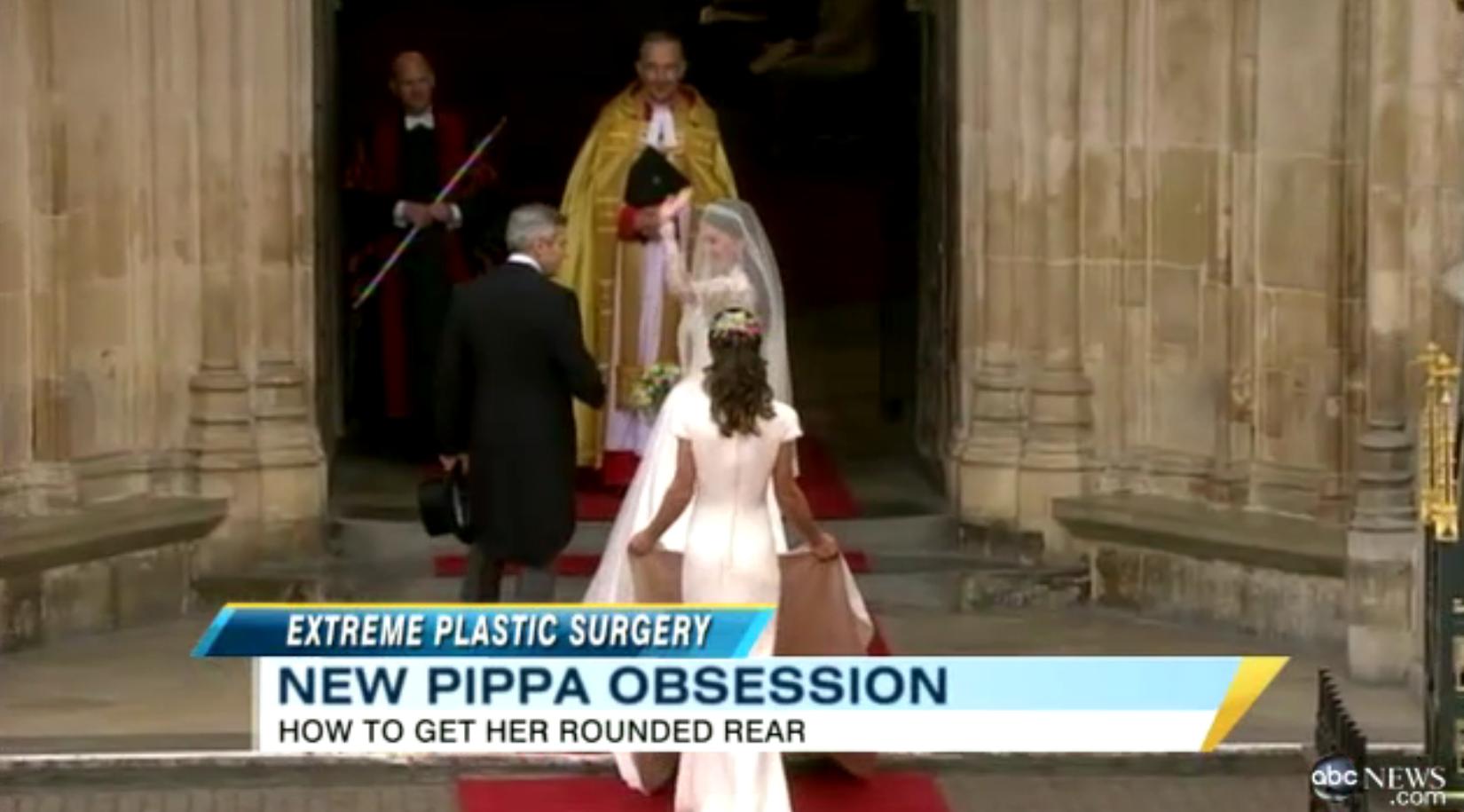 The Pippa Middleton Butt Complex: One Woman's Surgery Story