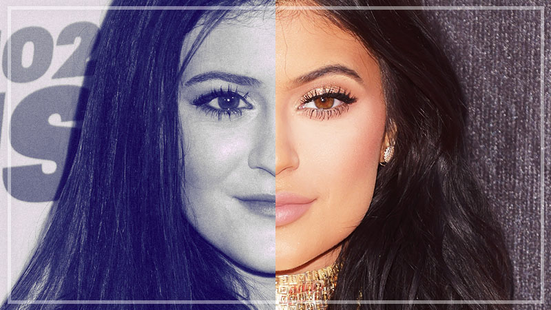kylie jenner face transformation