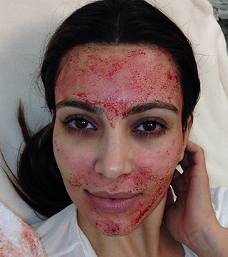 The Most Insane Beauty Treatments throughout History