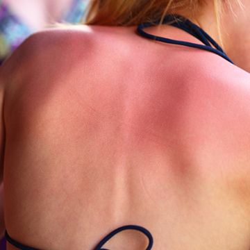 Seven Minerals' Aloe Vera Gel From Amazon Soothes Sunburns Overnight