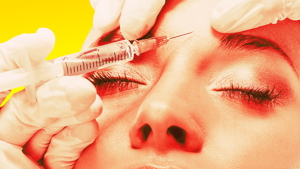 I Got Botox Again And Here's Why