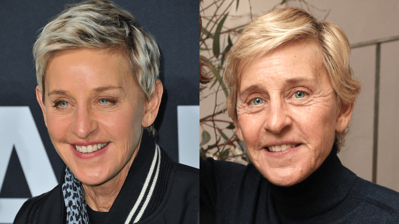 What happaned to Ellen DeGeneres' face?