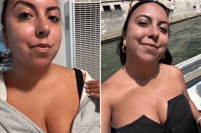 Left: Sam before using Solawave's neck and chest mask; Right: Sam after using Solawave's neck and chest mask. Photos: Samantha Leal.